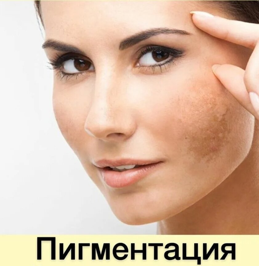 Кожа лица фото Услуги косметолога в Домодедово: 119 косметологов