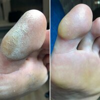 педикюр до, педикюр мужской, педикюр, педикюр без покрытия, педикюр с покрытием