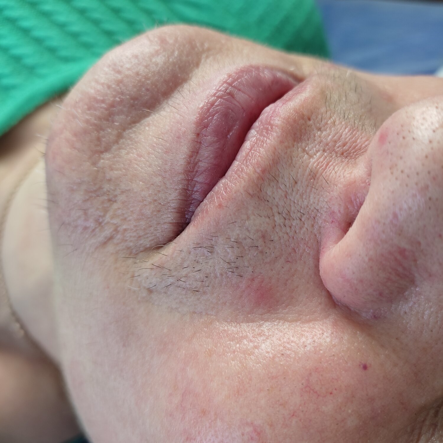 часть лица, губы, косметолог, нос, lips