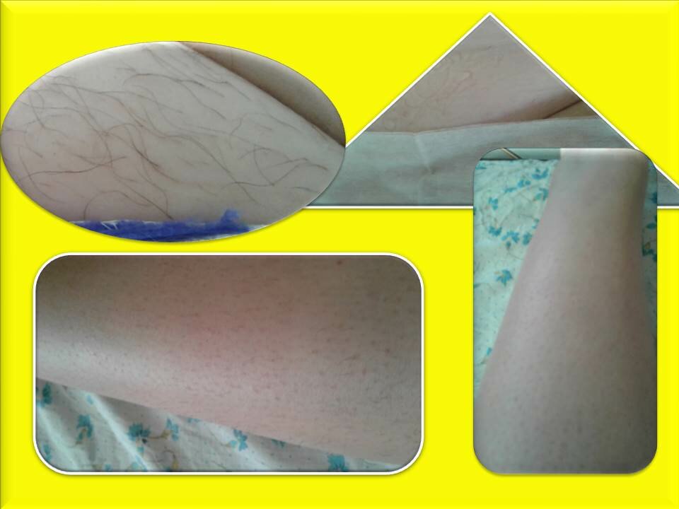 восковая эпиляция, эпиляция, депиляция, шугаринг, крем для депиляции eveline до и после