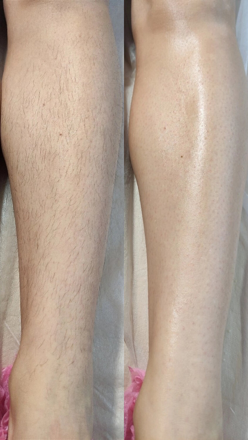 восковая депиляция, восковая депиляция спб, восковая эпиляция, депиляция, депиляция воском