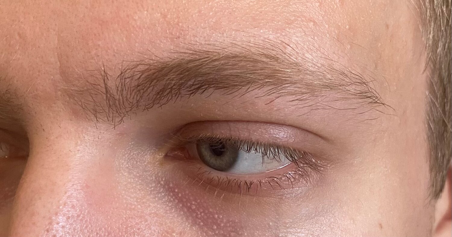 брови, закрытые глаза, человек, мужские брови, алопеция бровей