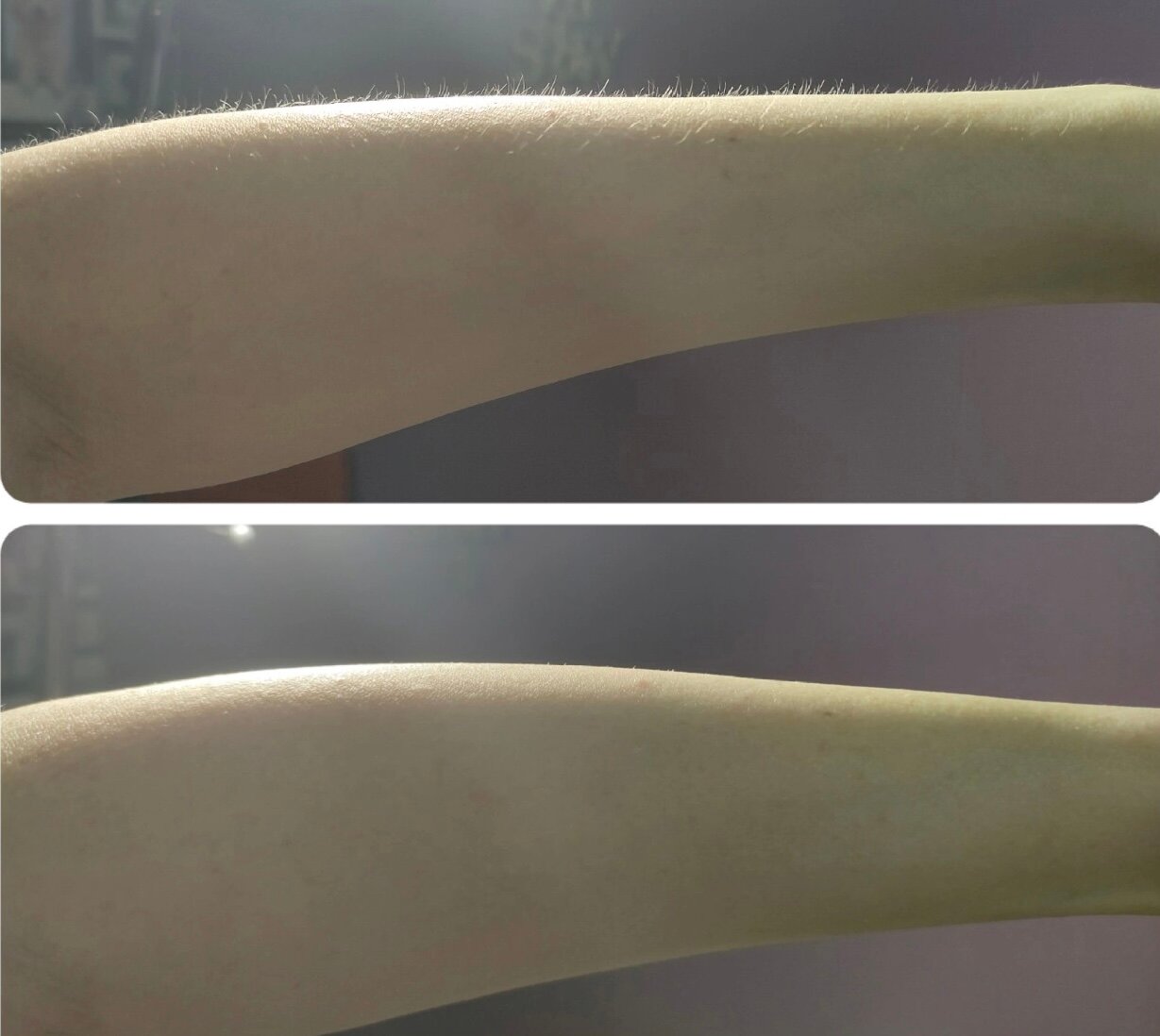 восковая депиляция, депиляция сахаром, депиляция воском, депиляция, шугаринг депиляция