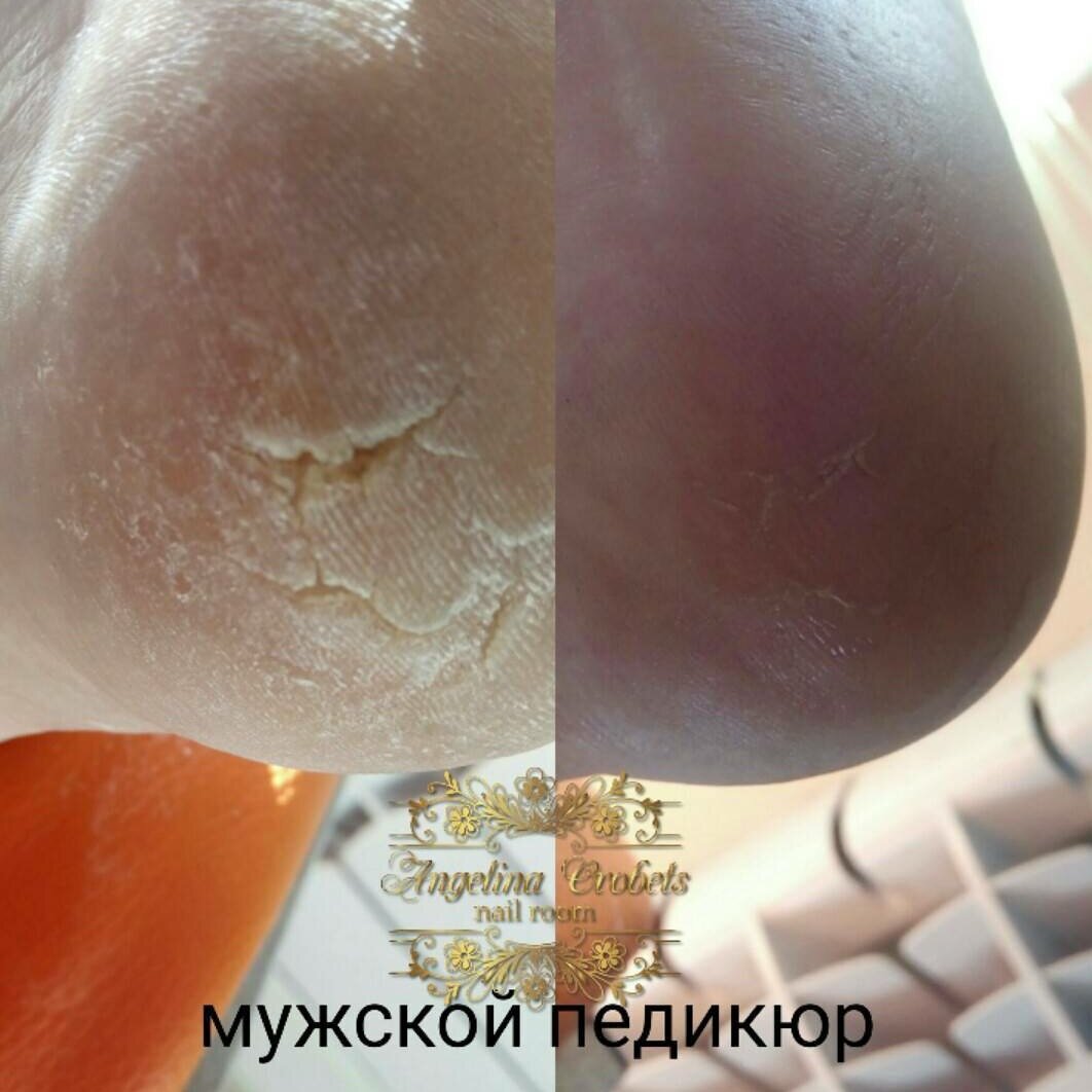 часть тела человека, педикюр, nail, тела, кислотный педикюр clearance