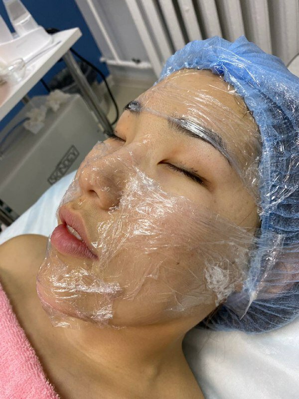 ультразвуковой пилинг лица, уз чистка лица, ультразвуковой пилинг, пилинг, пилинг для лица