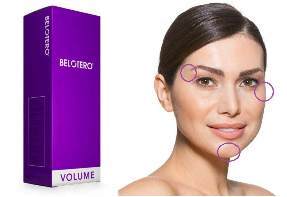 филлеры белотеро интенс, филлер belotero soft, белотеро интенс (intense), белотеро волюм, контурная пластика белотеро