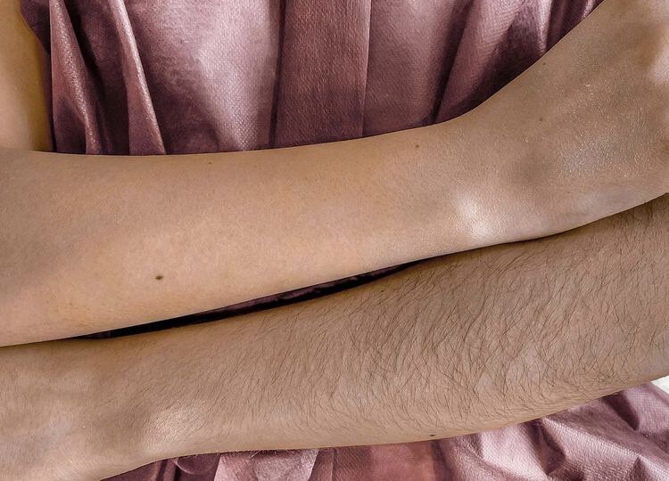 шугаринг рук, шугаринг ног, восковая депиляция, шугаринг депиляция, шугаринга
