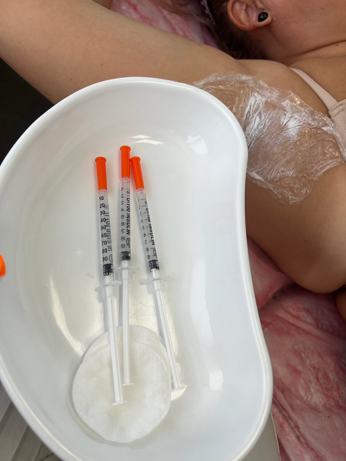 часть тела, avanti+ интродьюсер 6f, косметические процедуры, treatment, инъекции косметология