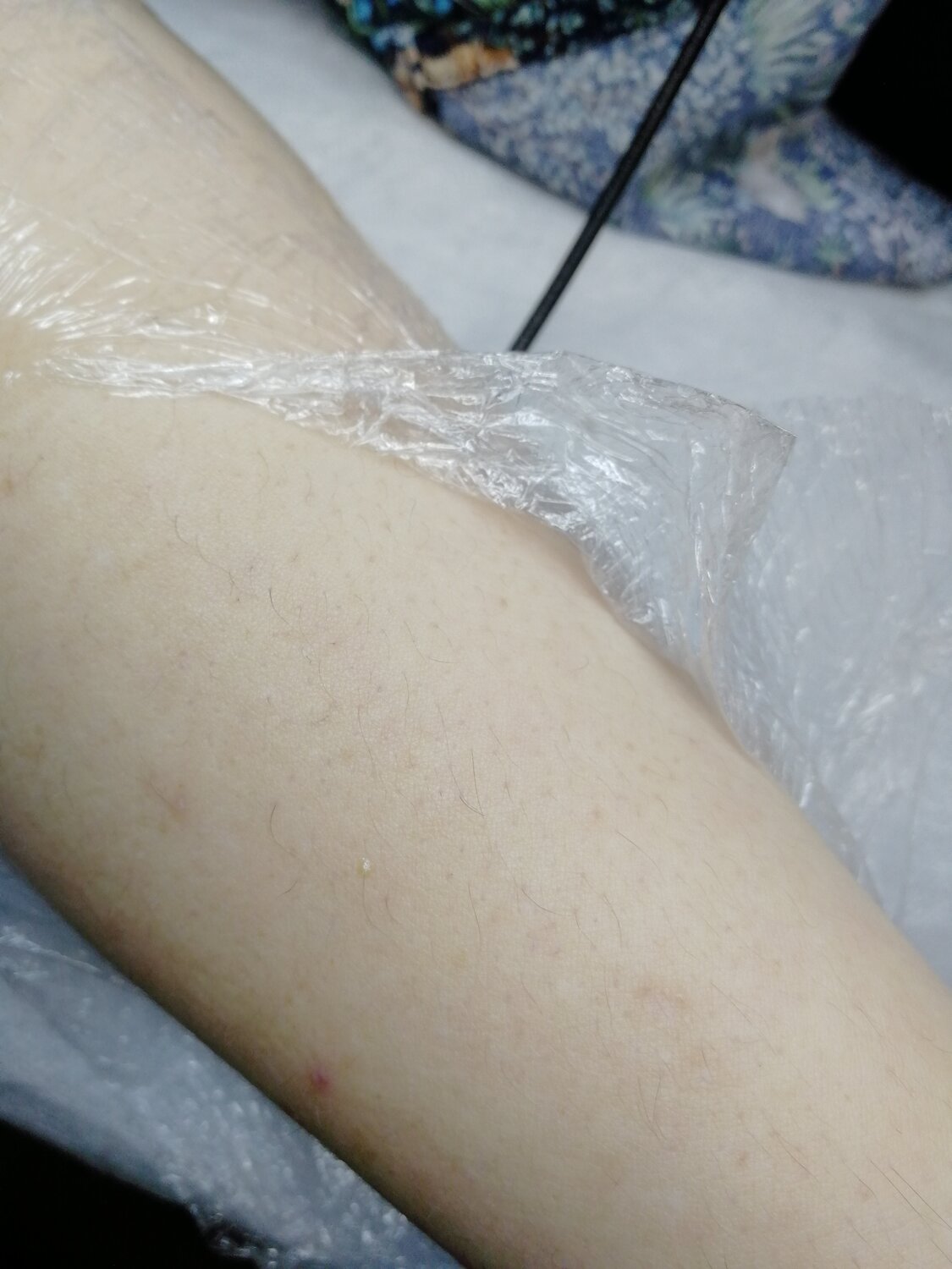 женская депиляция, электроэпиляция, депиляция, депиляция крем, шугаринг депиляция
