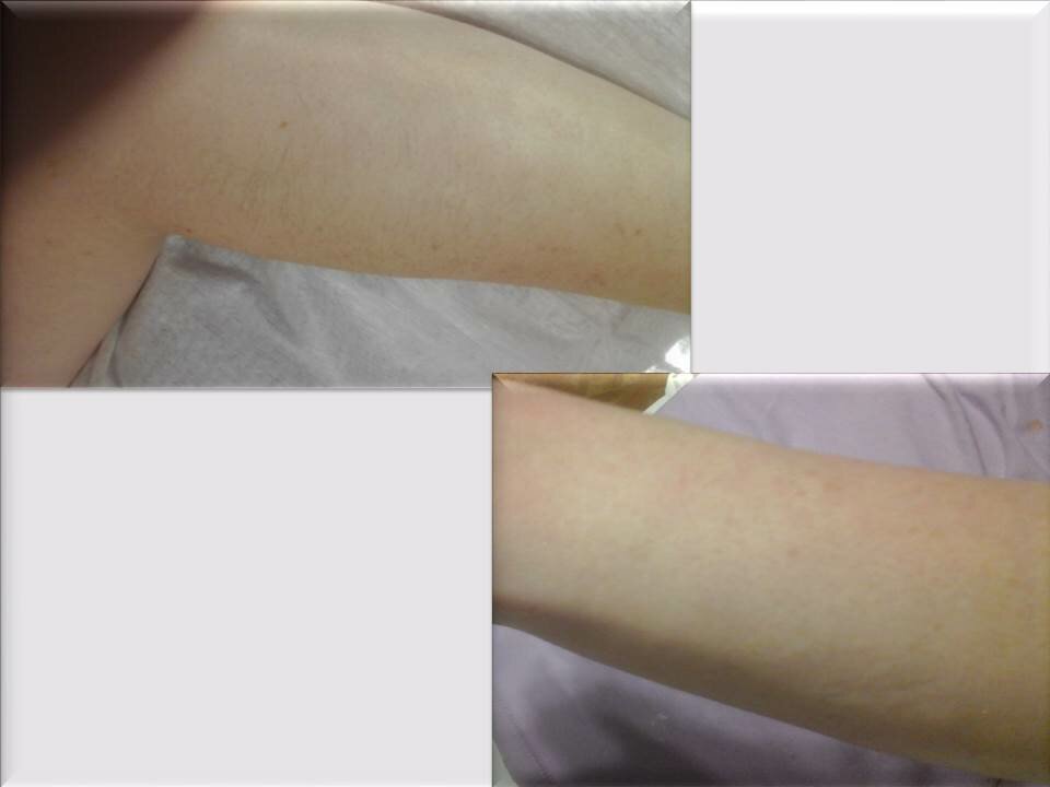 часть тела человека, депиляция, эпиляция, шугаринг, восковая эпиляция