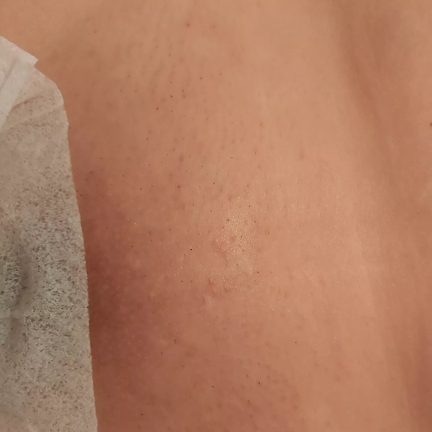 часть тела человека, тела, skin, пот на коже, пятно
