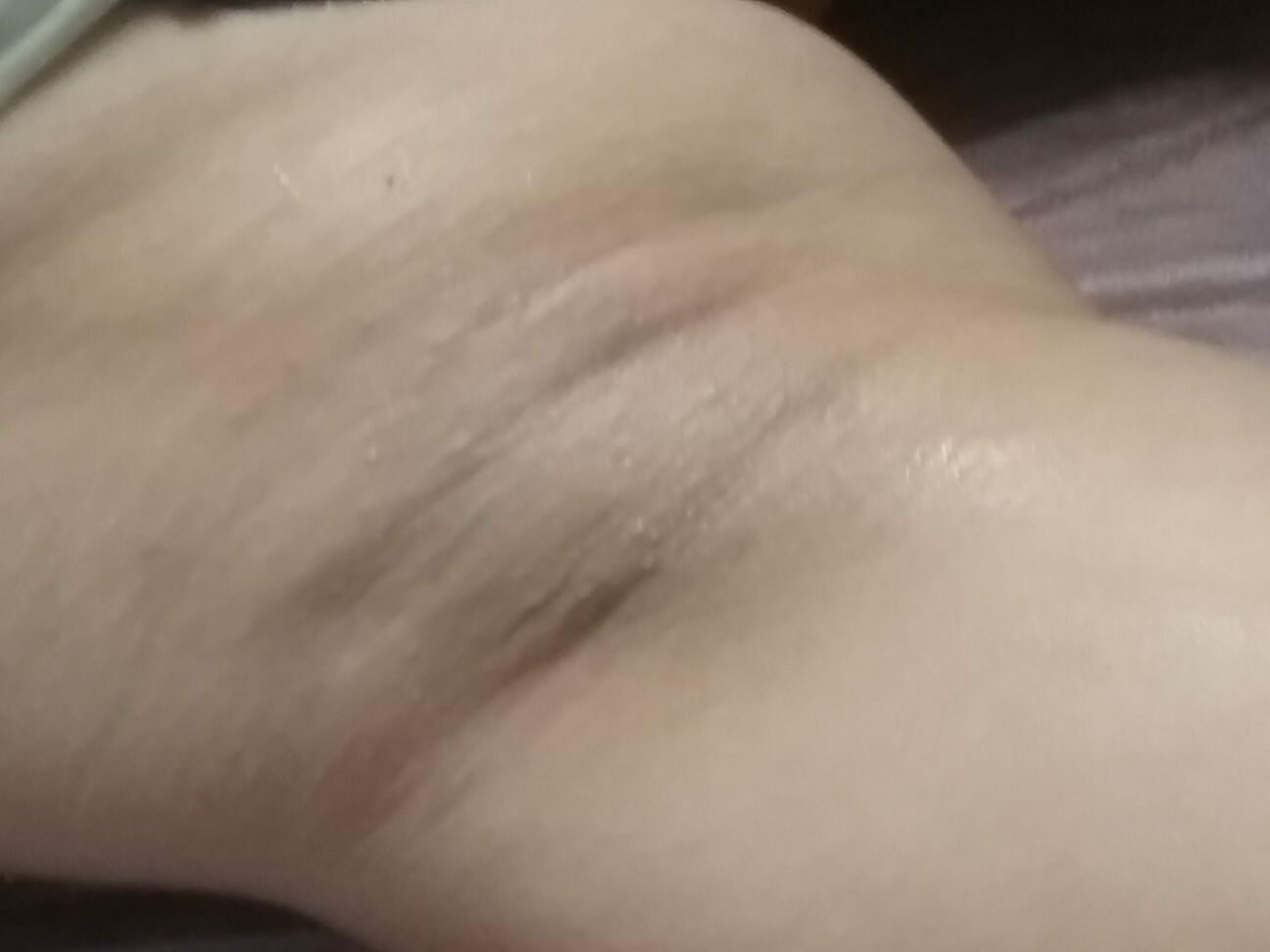 часть тела человека, восковая эпиляция, шугаринг глубокое, тела, депиляция