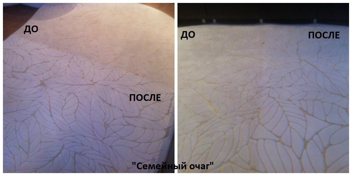 волосы до и после шугаринга схема, шугаринга, кожа после депиляции бикини, депиляция, шугаринг