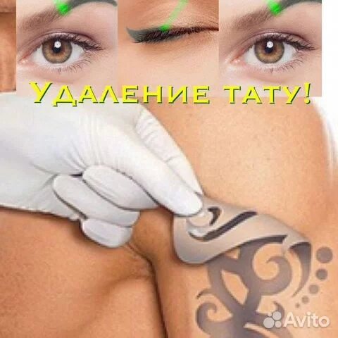 удаление тату лазером, удаление татуировок лазером, лазерное удаление татуировок, удаление татуажа лазером, лазерное удаление татуажа