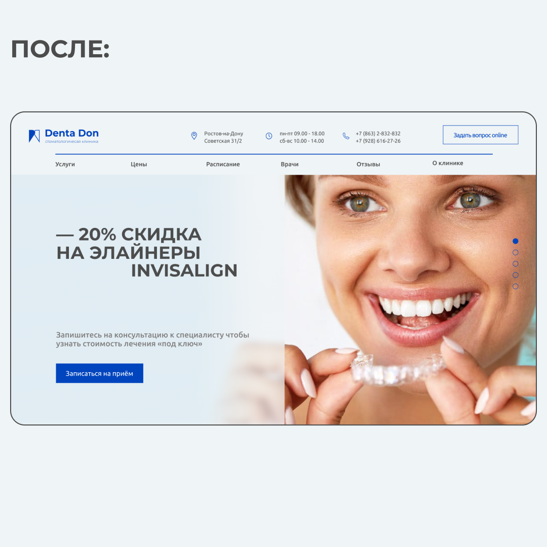 американские элайнеры invisalign, элайнеры калининград, элайнеры на зубах девушки, элайнеры бибера, элайнеры инвизибл