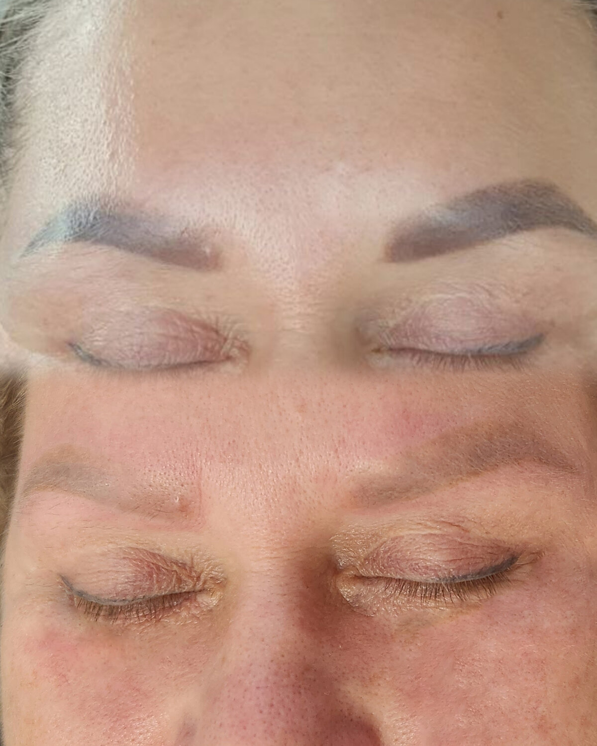 татуаж, татуаж брови, удаление татуажа, удаление татуажа бровей лазером, микроблейдинг бровей мужчинам