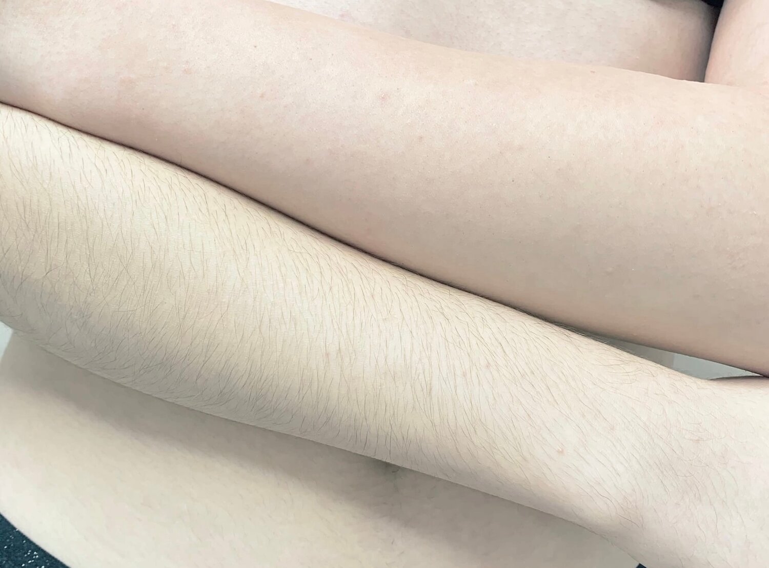 восковая депиляция, шугаринг рук, шугаринг депиляция, депиляция, шугаринг