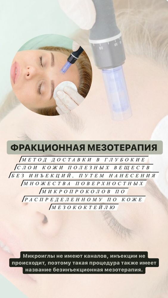 фракционная мезотерапия, фракционная мезотерапия лица, фракционная мезотерапия лица дермапеном, мезотерапия, мезотерапия лица