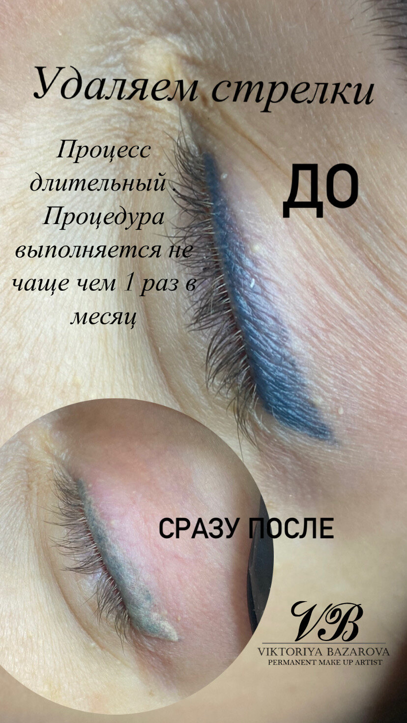 ремувер татуажа век, удаление татуажа век, ремувер для снятия татуажа стрелок, перманентный макияж век стрелки с растушевкой, татуаж глаз стрелки