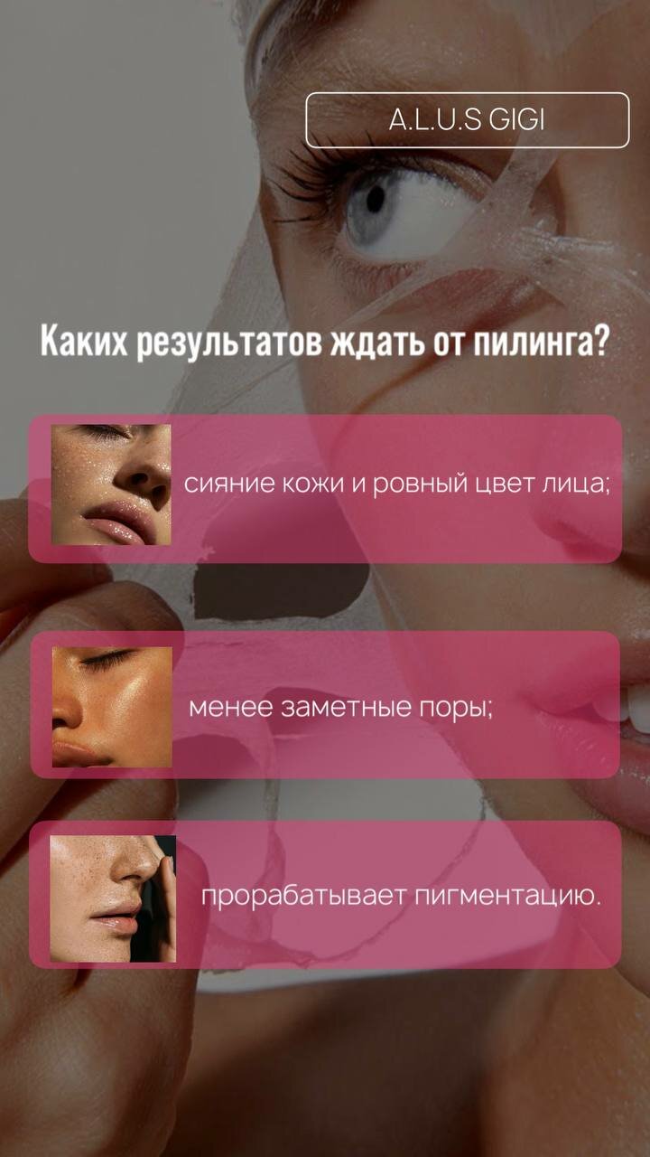 идеальная кожа, пилинг, чистка лица, лицо кожа, лицо косметология