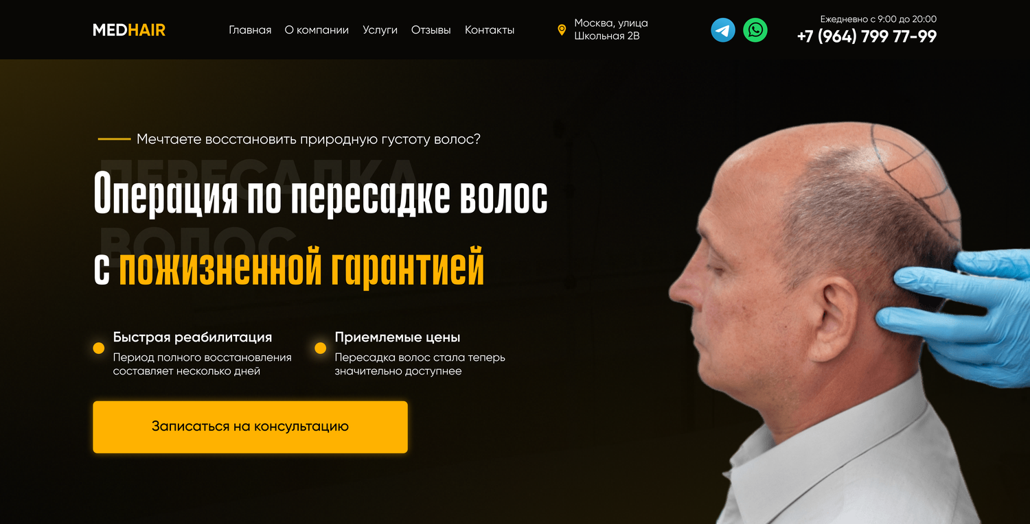 пересадка волос, трансплантация волос, лечение выпадения волос, hair transplant, после пересадки волос