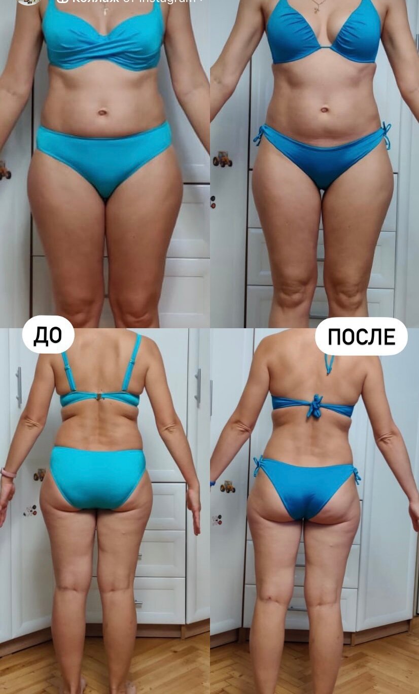 до и после, целлюлит до и после, массаж до и после, после, до и после антицеллюлитного массажа