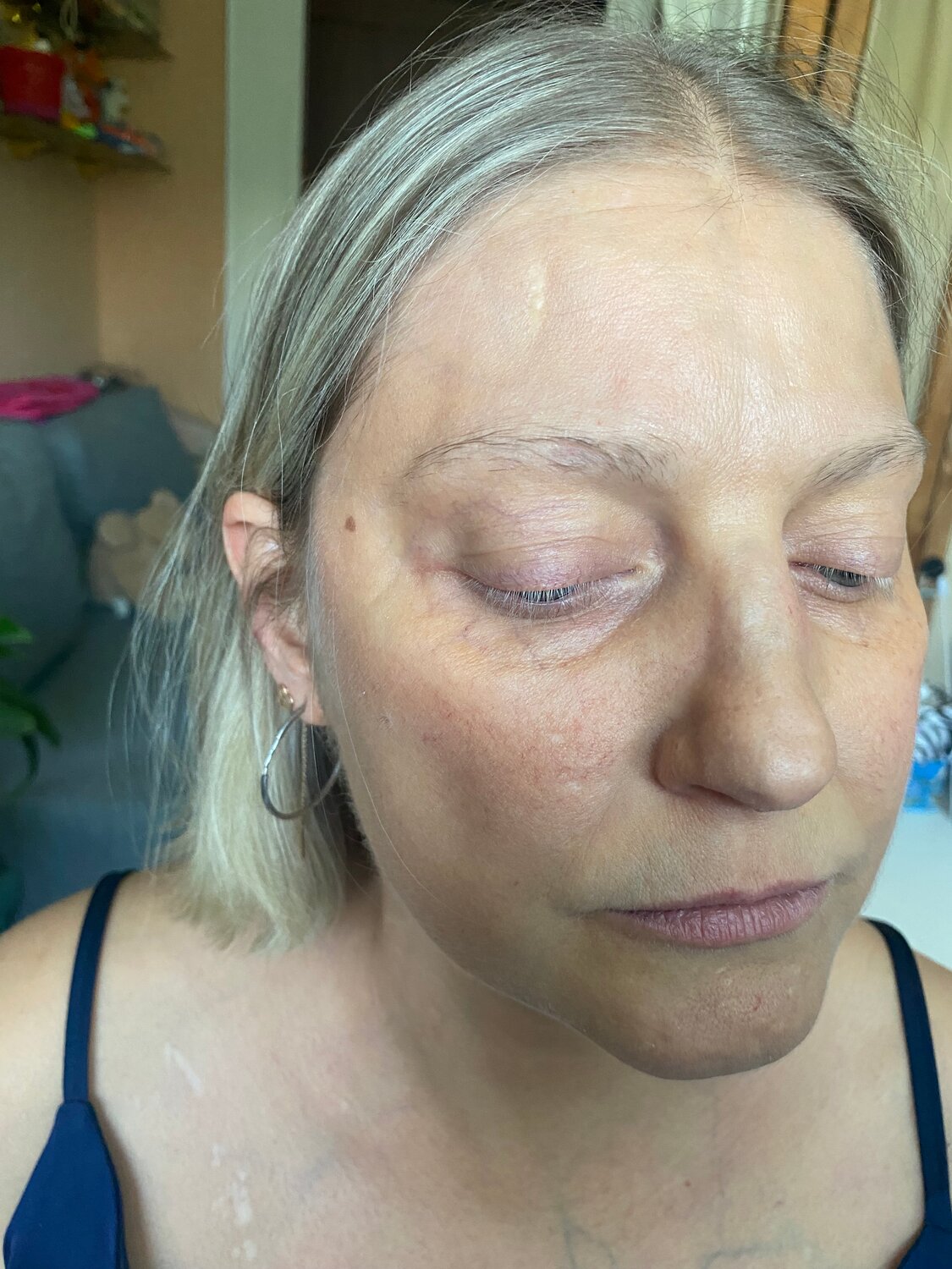 перманентный макияж, пилинг для лица, пилинг, третиноин пилинг для лица, кожа лица