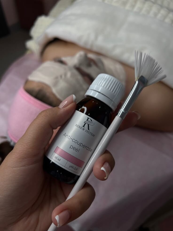 феруловый пилинг sesderma, пилинг, феруловый пилинг, химические пилинги, пилинг для лица