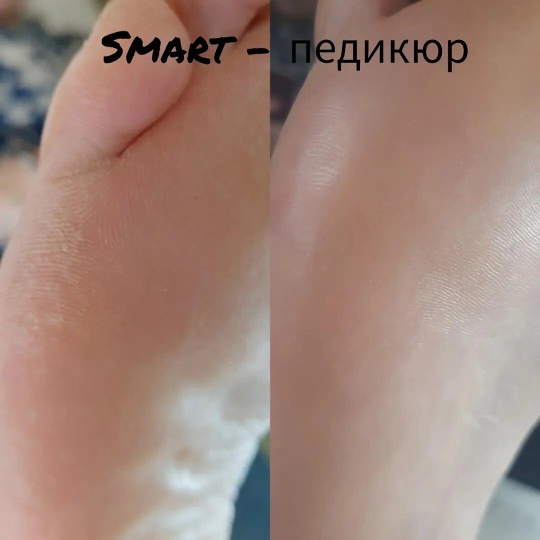 педикюр, женский педикюр до, комбинированный педикюр, педикюр маникюр, аппаратный педикюр