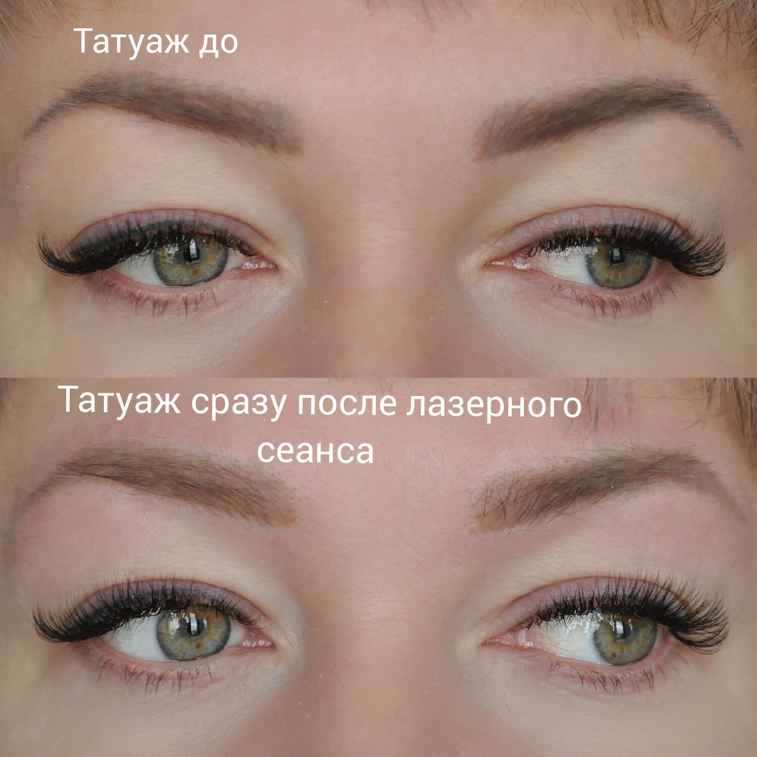 татуаж, брови после татуажа, татуаж брови, удаление татуажа, татуаж дмитров