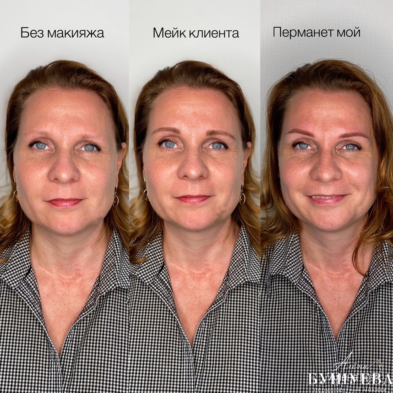 девушка, пластика лица, лицо, омоложение лица, красивые брови