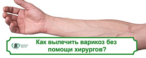 familydoctor-flebolog-003.jpg