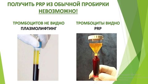 Плазмолифтинг - это не PRP!  mc-rost.ru.jpg