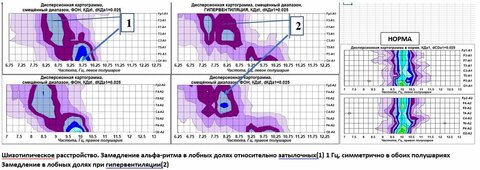 Шизотипическое расстройство.jpg