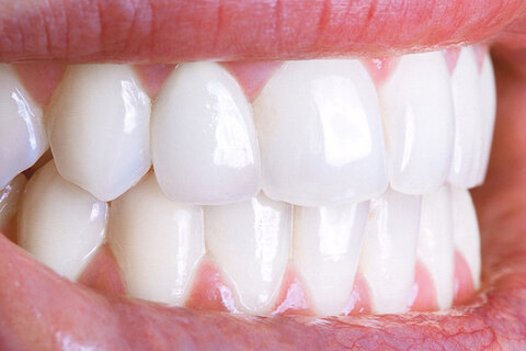 https://www.dynamicsmiledesign.com/blog/assets/uploads/2019/11/iStock-945861704.jpg