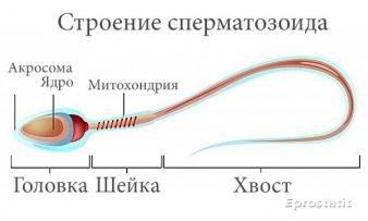 Тератозооспермия: причины и лечение. Сперматозоиды патологических форм.