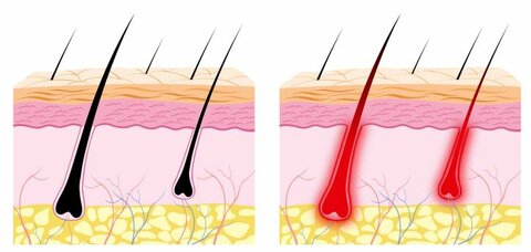 https://otrazhenie-clinic.ru/wp-content/uploads/2020/08/vozdeystvie_na_volos_1.jpg