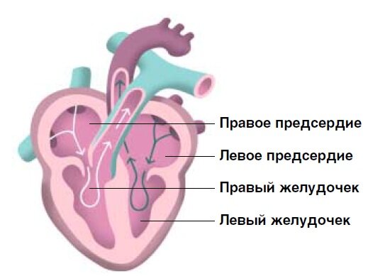 Электростимулятор для сердца