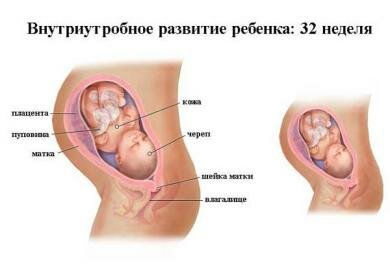 32 Неделя Беременности Фото Плода