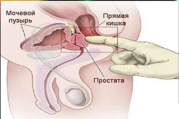 analize pentru prostată masaj spatelui pentru prostatită