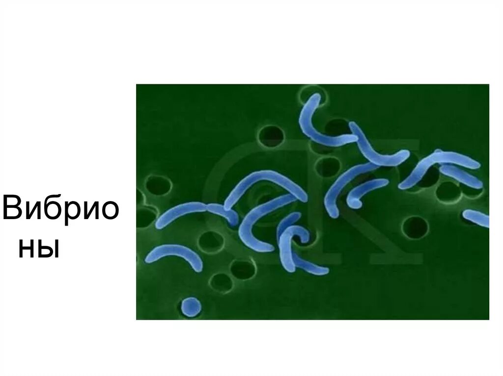 Известно что холерный вибрион вид подвижных. Вибрион холеры строение. Вибрион Коха. Вибрио холера морфология. Тип бактерий вибрионы.