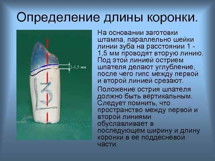 Длина коронки зуба. Длина коронки зуба. Метод определения рабочей длины корневого канала. Длина зуба корня коронки. Длина коронки зуба.