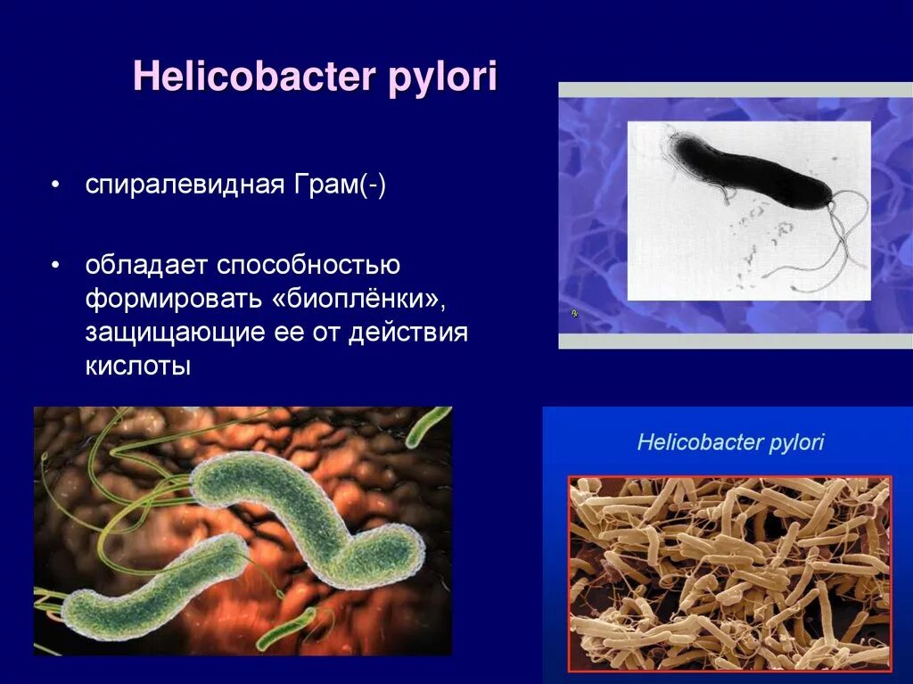 Пилори язва. Хеликобактер пилори 2,7. Helicobacter pylori микроскопия. Хеликобактер таксономия.