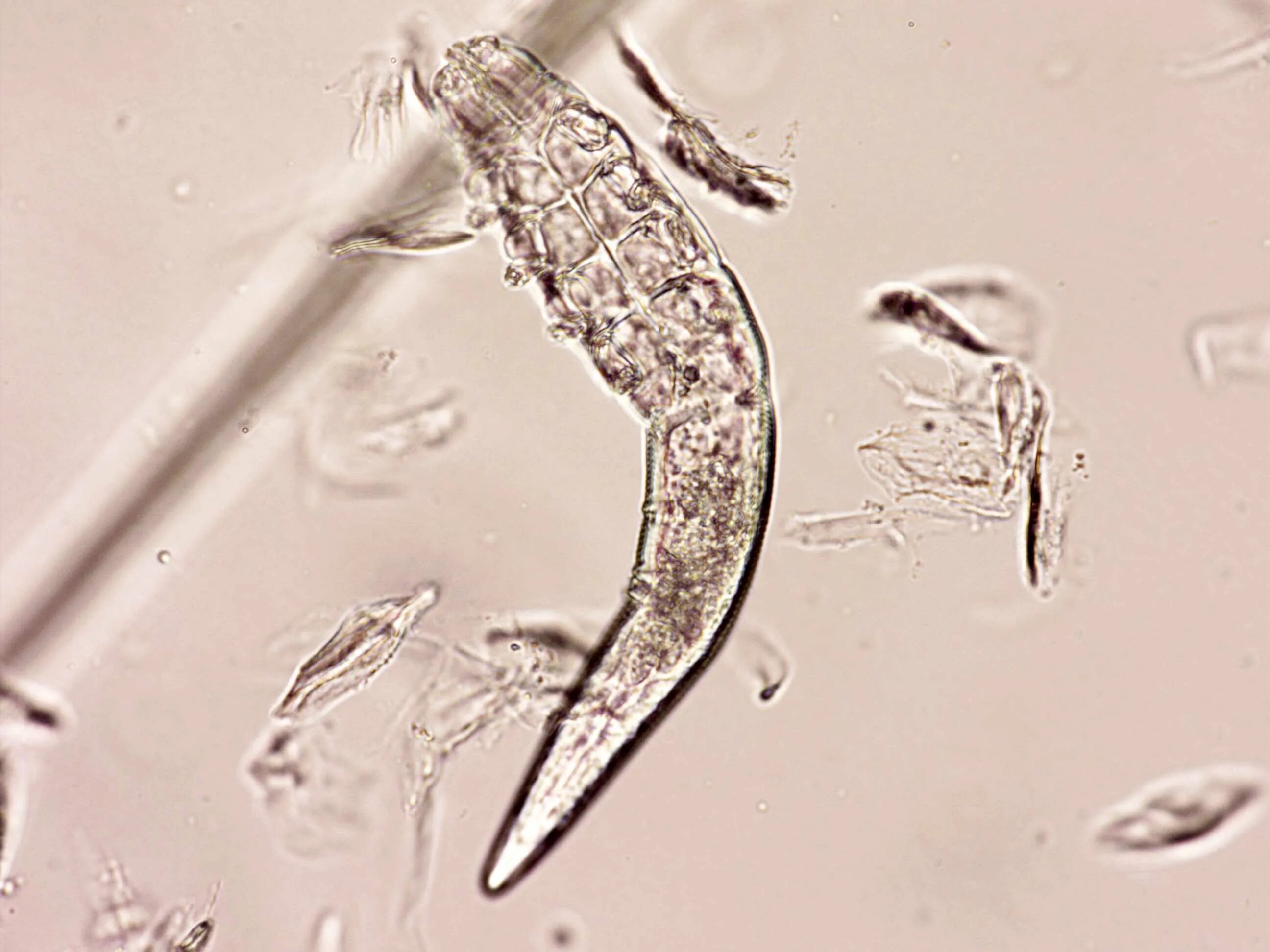 Демодекоз Ветеринария. Клещ Demodex folliculorum микроскоп