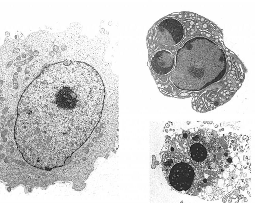 Микроскопические изменения в клетках. Апоптоз микрофотография. Апоптоз клетки микроскоп. Клеточный апоптоз. Некроз клетки микрофотографии.