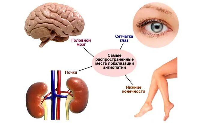 Почечные глаза