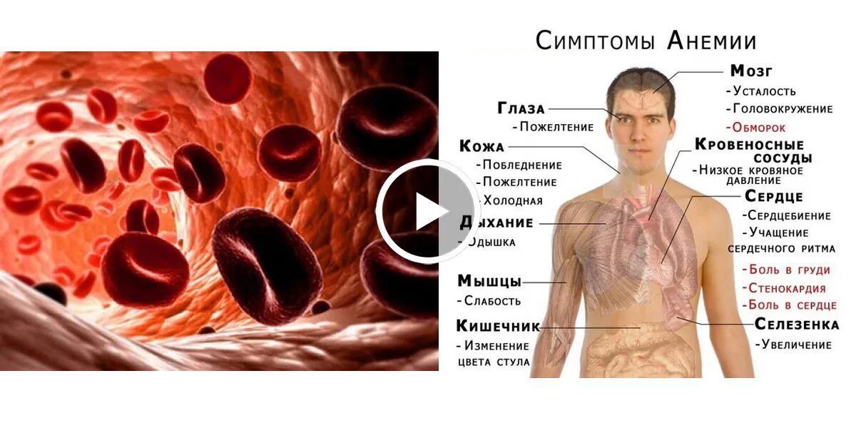 Анемия матки. Анемия низкий гемоглобин. человек с повышенным гемоглобином.