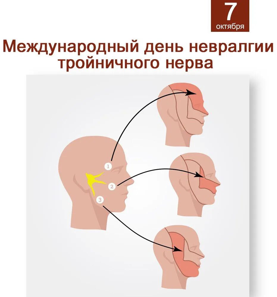 Невралгия тройничного лицевого нерва. Невралгия тройничного нерва психосоматика. Тройничный нерв психосоматика. Психосоматика лицевой нерв. Воспаление нерва можно ли греть