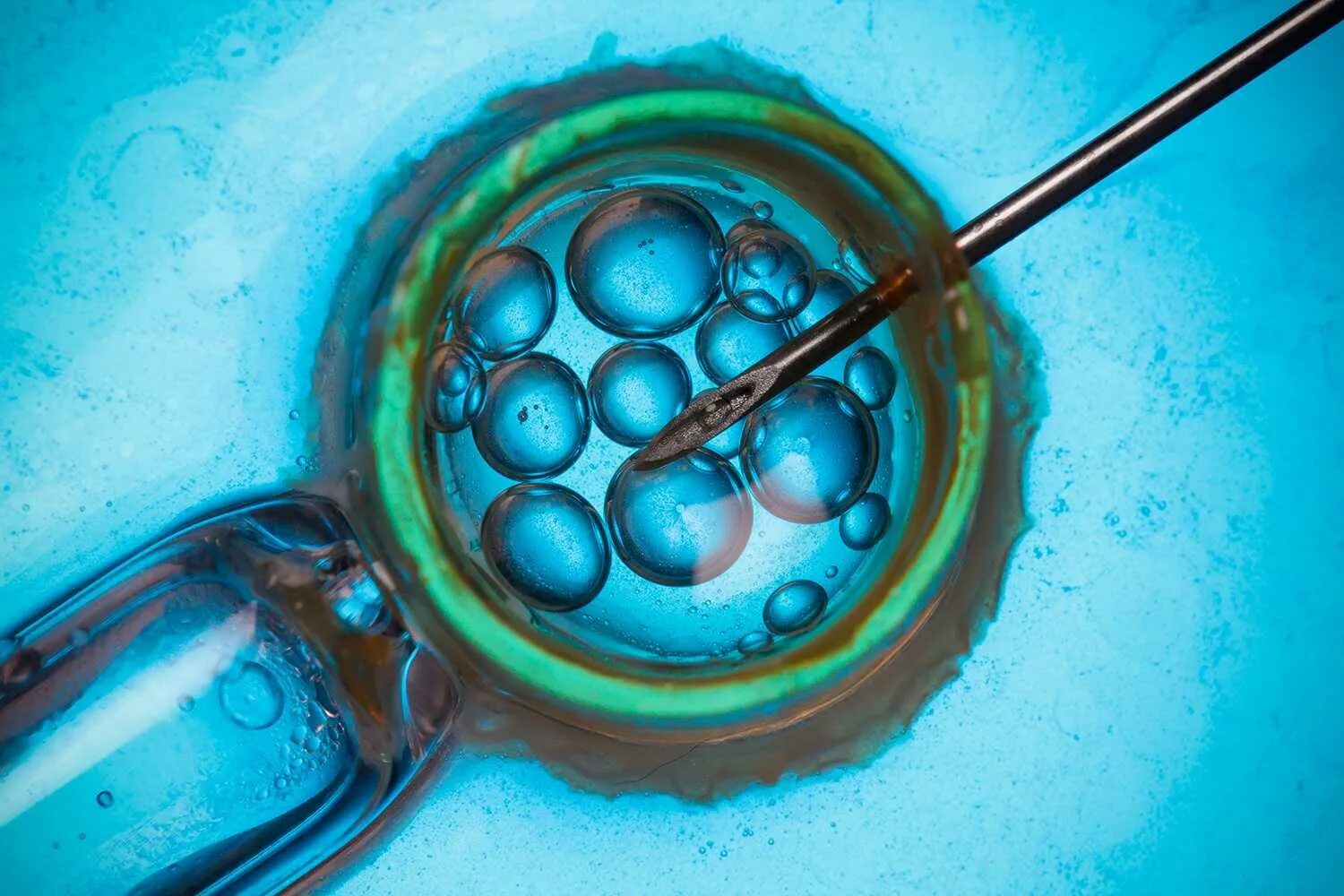 Экстракорпоральное оплодотворение. Эко экстракорпоральное оплодотворение. Экстракорпоральное оплодотворение это метод. Хетчинг эмбрионов.