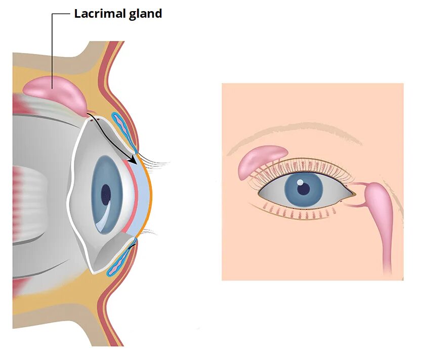 Как пробивают слезный канал. Слезная железа lacrimal Gland. Воспаление слезного мешка. Дакриоцистит анатомия. Заболевание слезного аппарата дакриоцистит.
